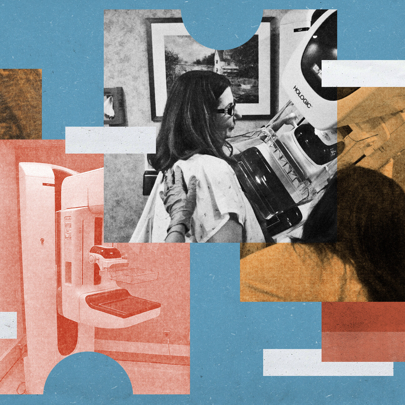 3-D Mammograms Are Overtaking Traditional Scans. Are They Better?