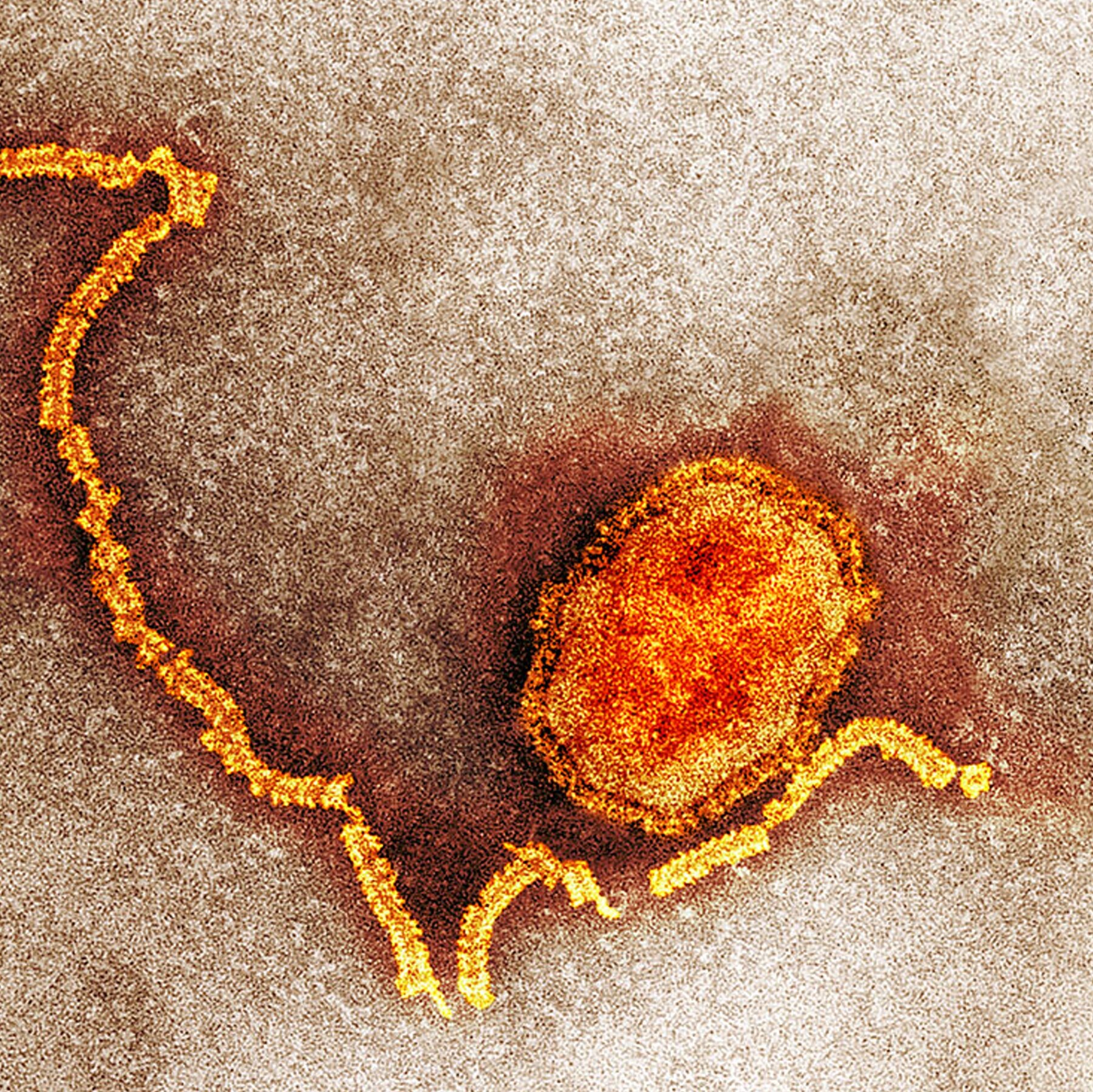 A 1990 Measles Outbreak Shows How the Disease Can Roar Back