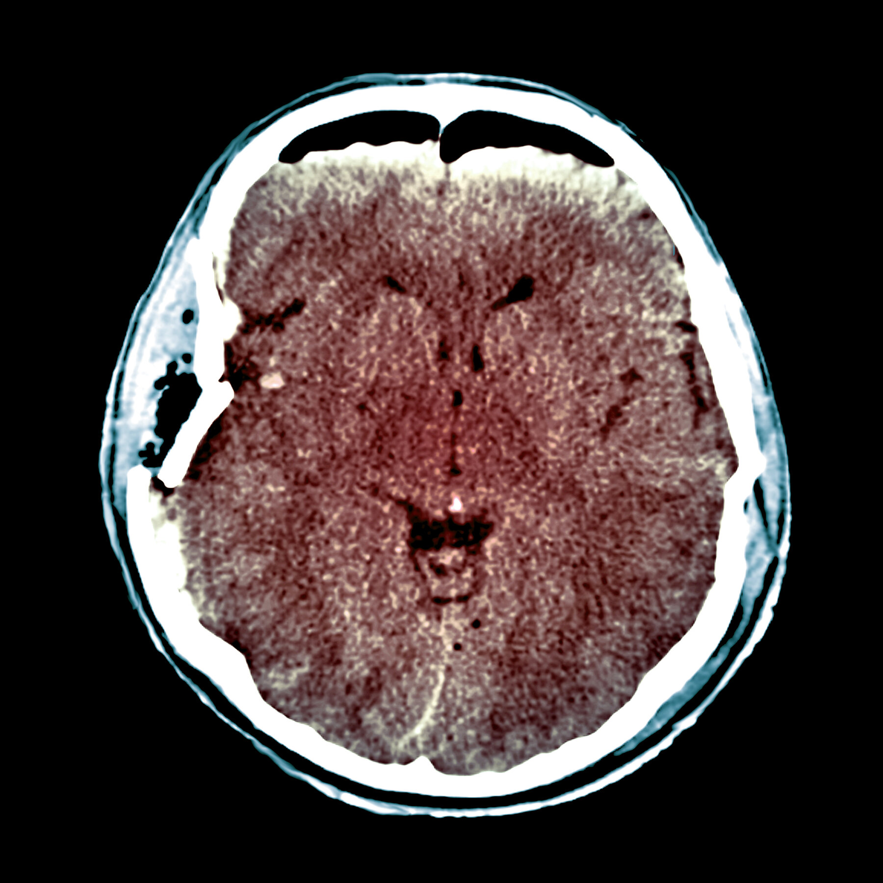 A New System Aims to Save Injured Brains and Lives