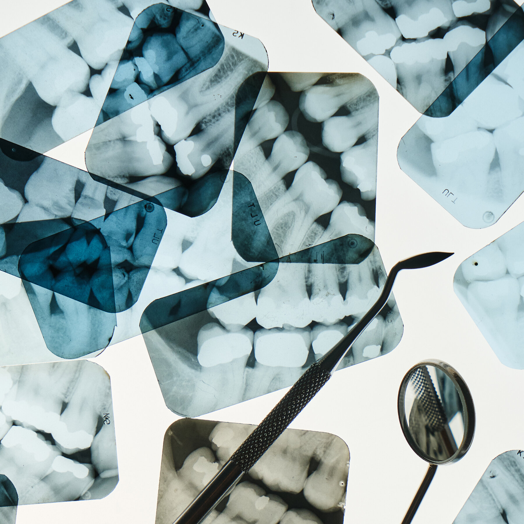 Are Dental X-Rays Safe?