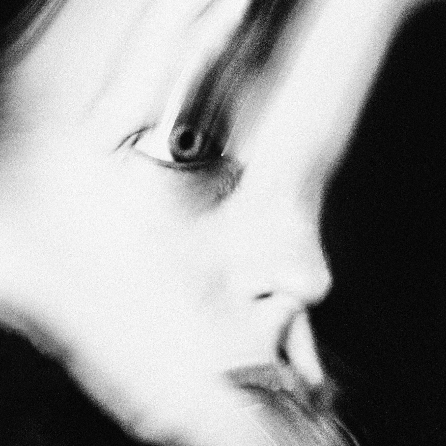 Chronic Pain Afflicts Billions of People. It’s Time for a Revolution.