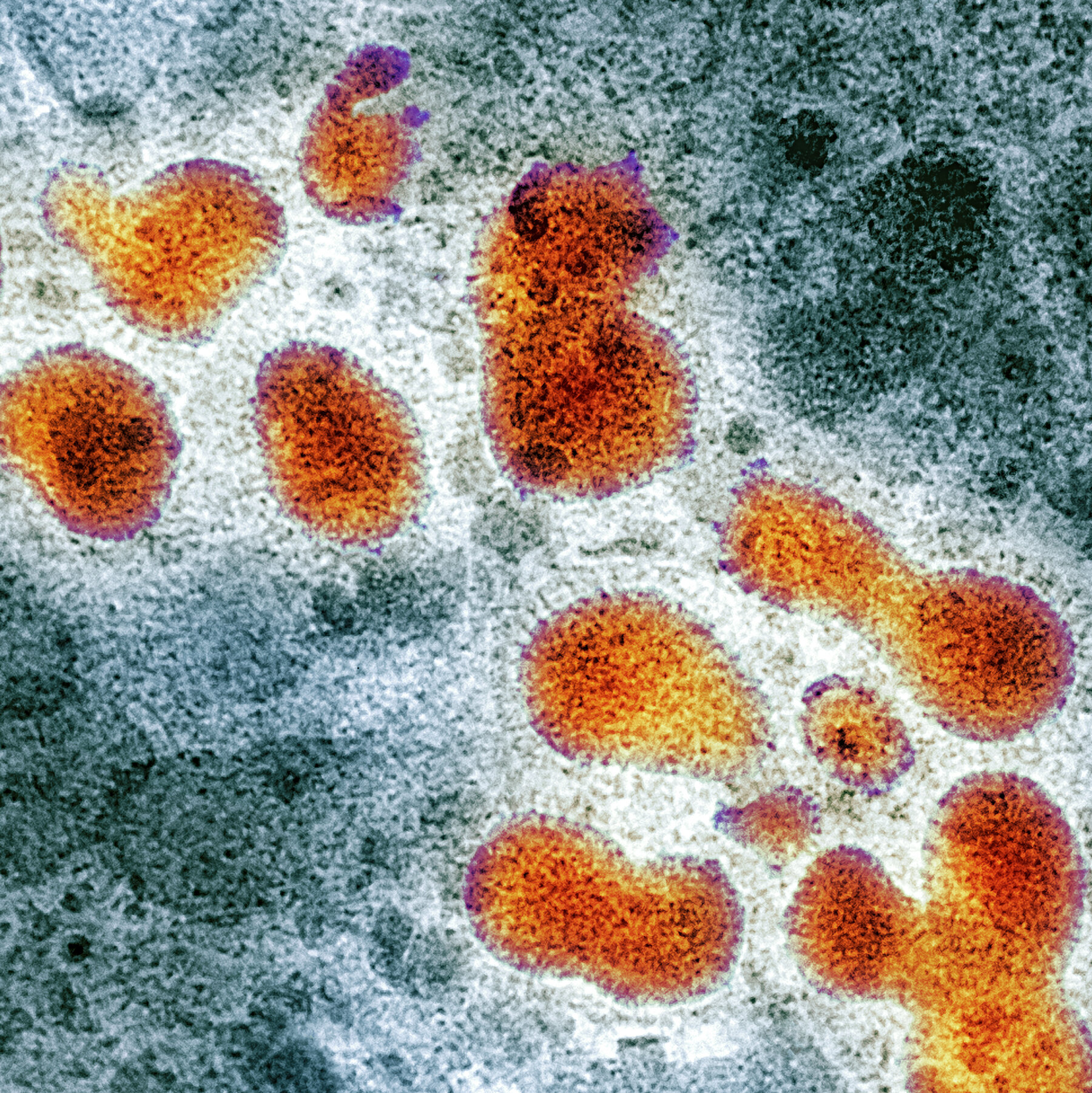 Could the Bird Flu Become Airborne?