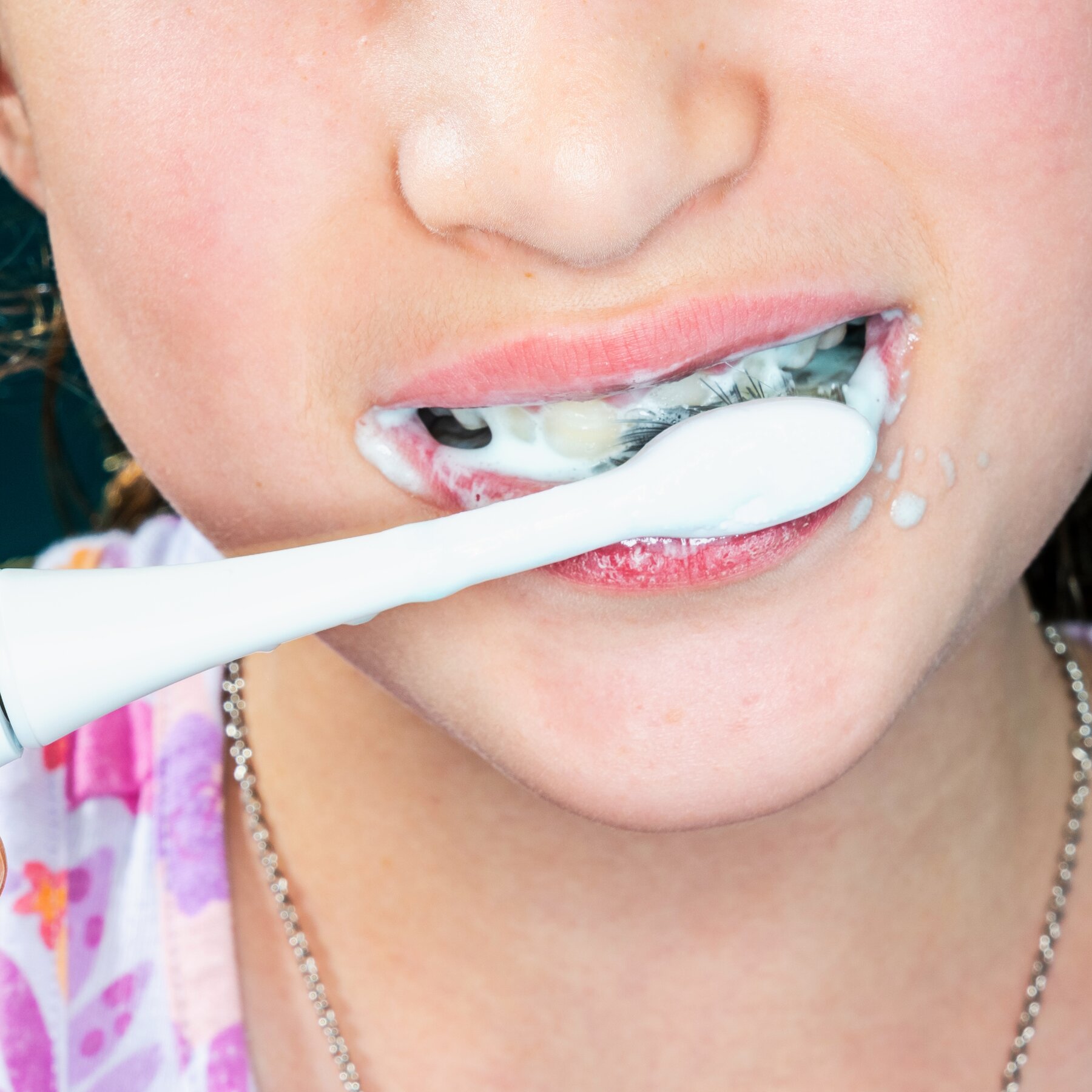 FDA Moves to Take Fluoride Supplements for Children Off the Market