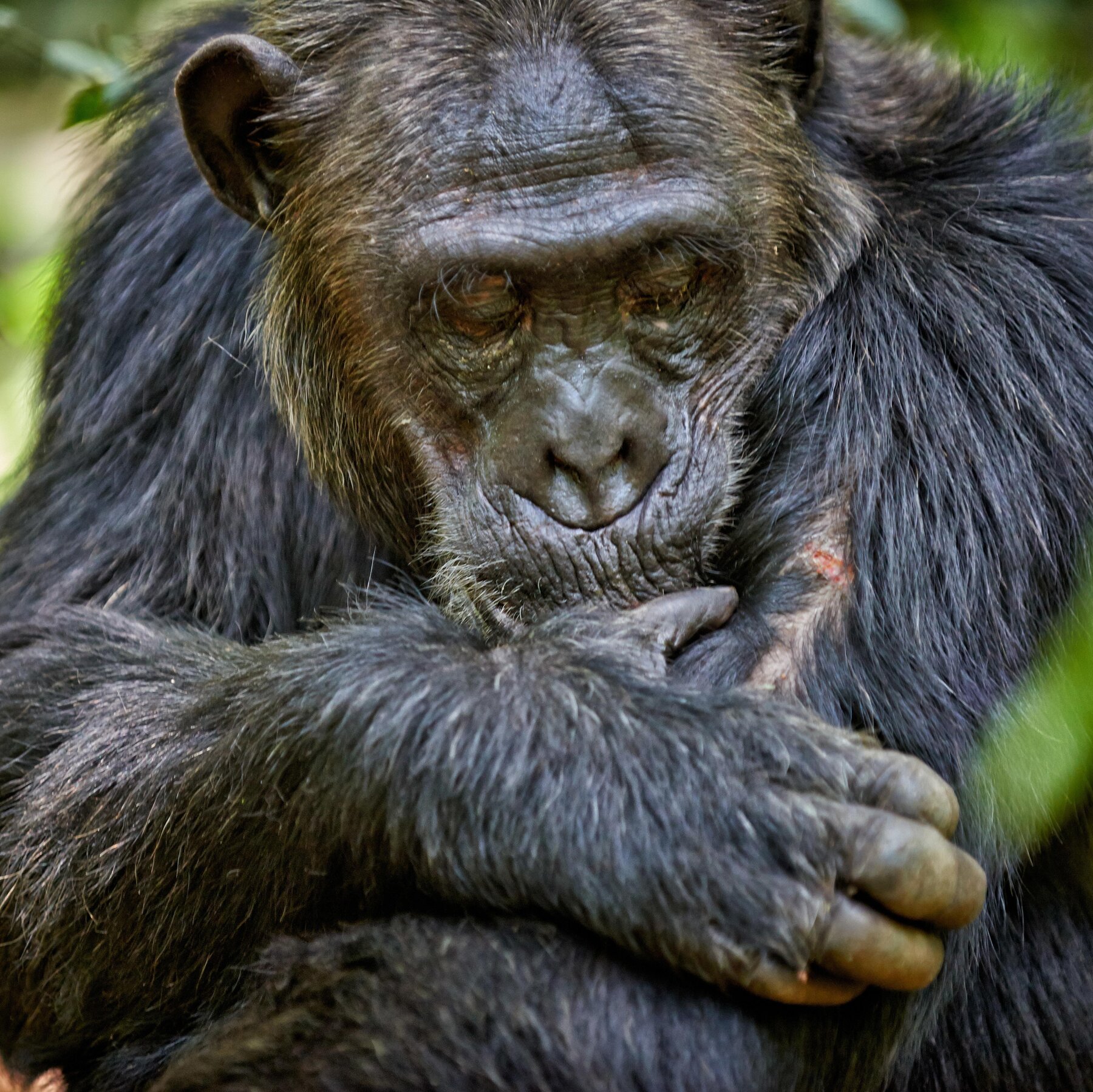Humans’ Wounds Heal Much More Slowly Than Other Mammals’