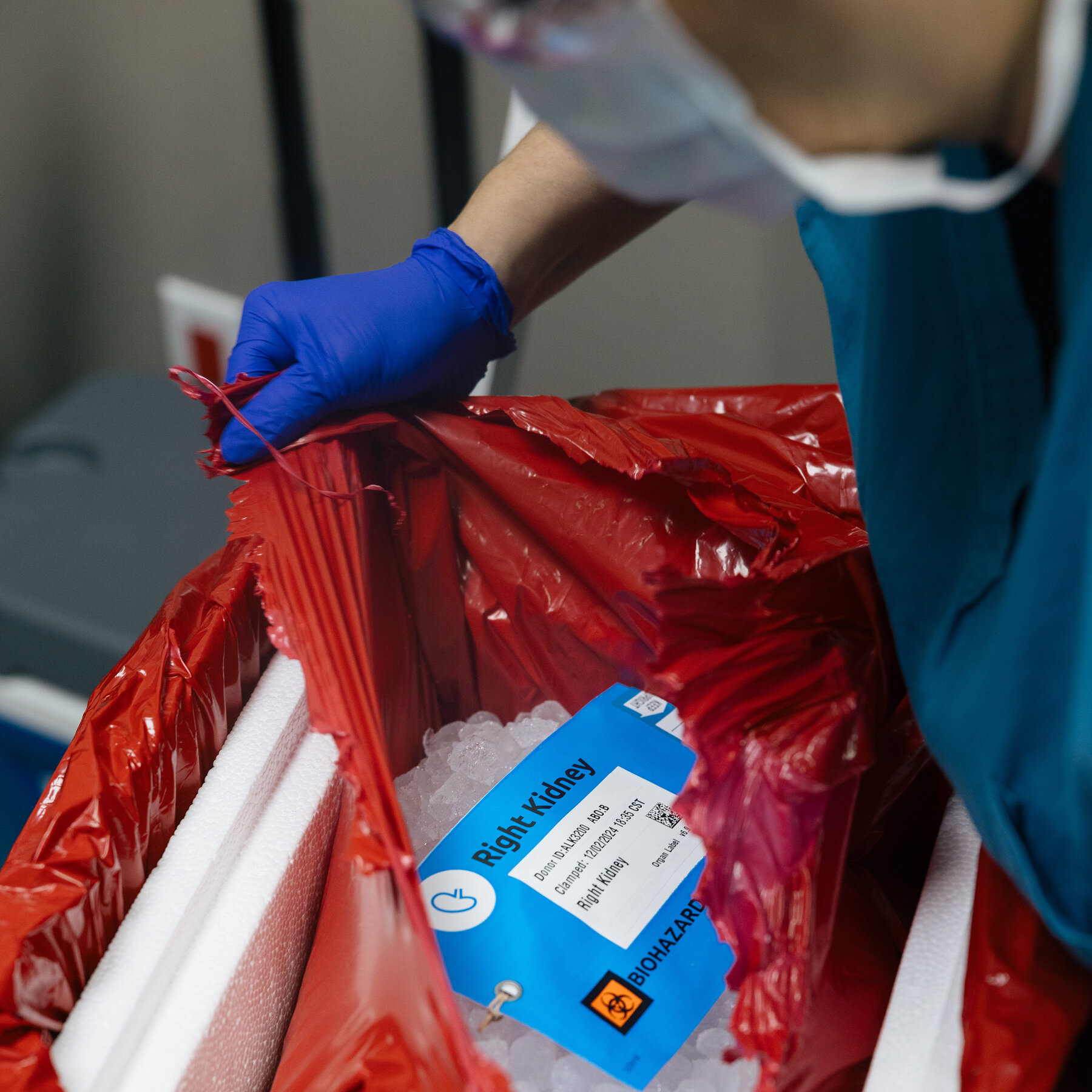 Organ Donation: What to Know About the Process
