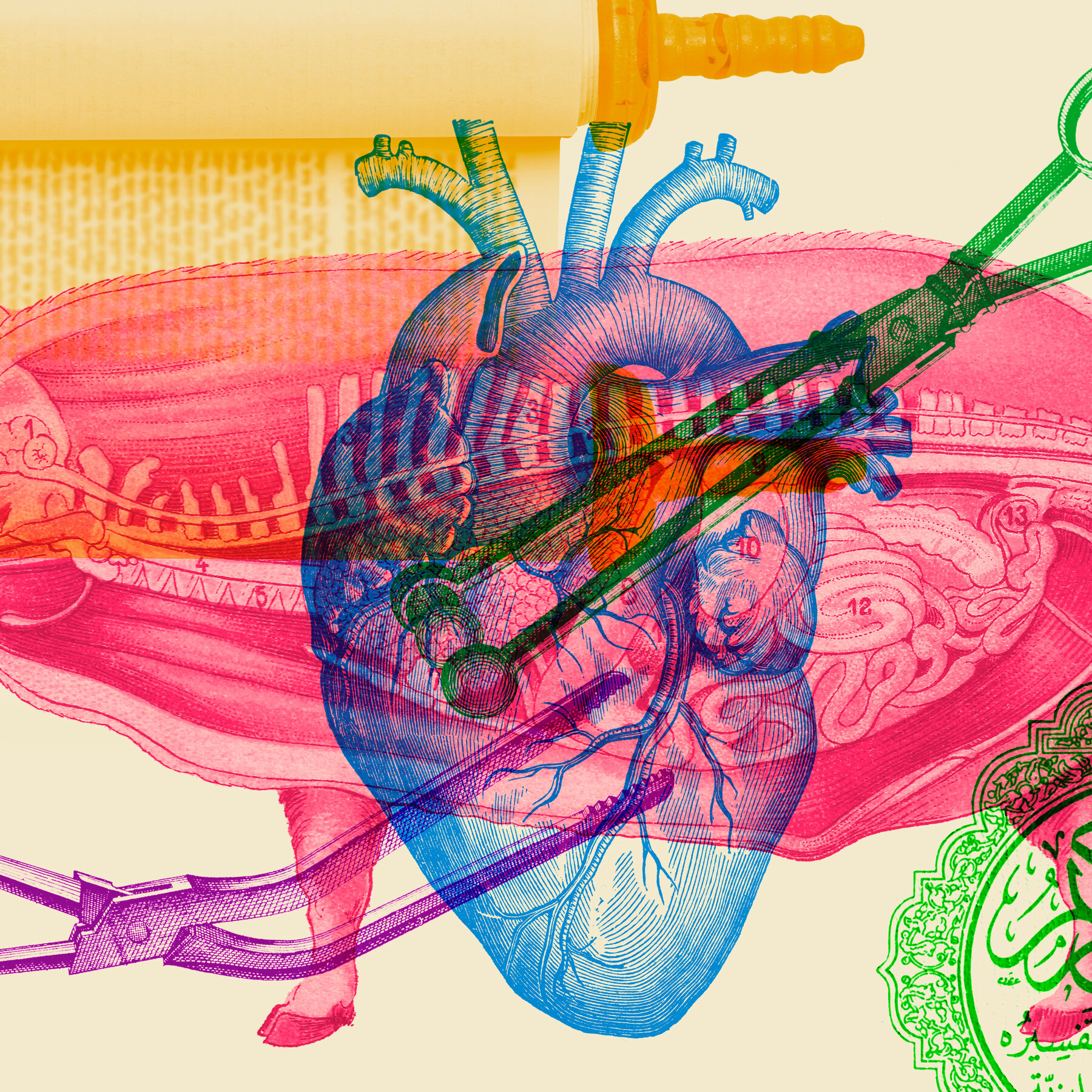 Pig Organ Transplants May Pose a Dilemma for Some Jews and Muslims