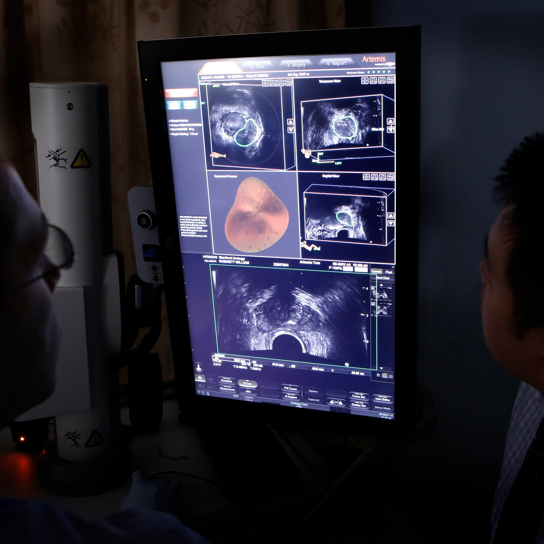 Reduced Screening May Have Led to Rise in Advanced Prostate Cancer Diagnoses