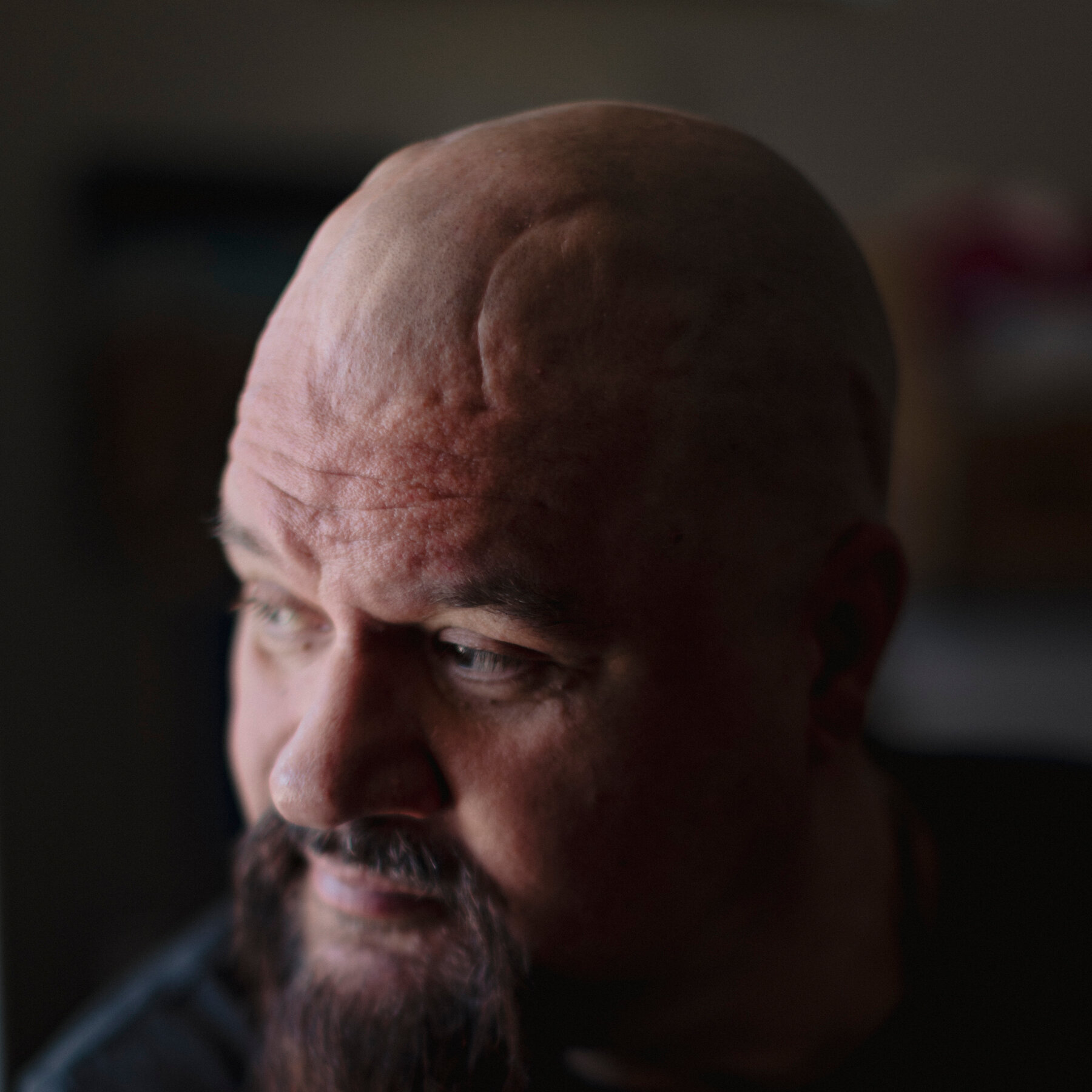 Treating Chronic Pain is Hard. An Experimental Approach Shows Promise.