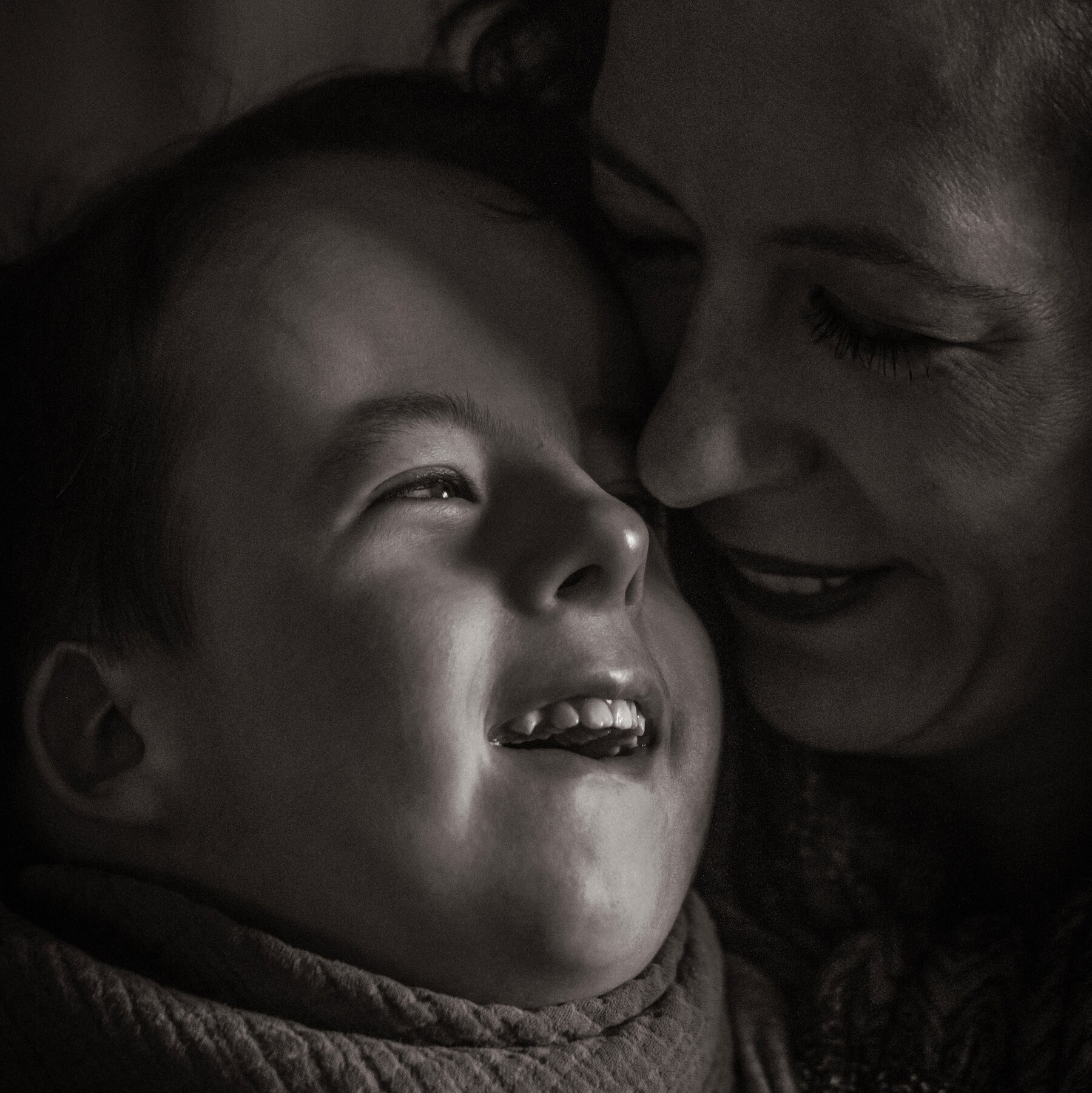 Trisomy 18 Was Once Seen as Too Lethal to Treat. Some Kids Are Now Surviving.