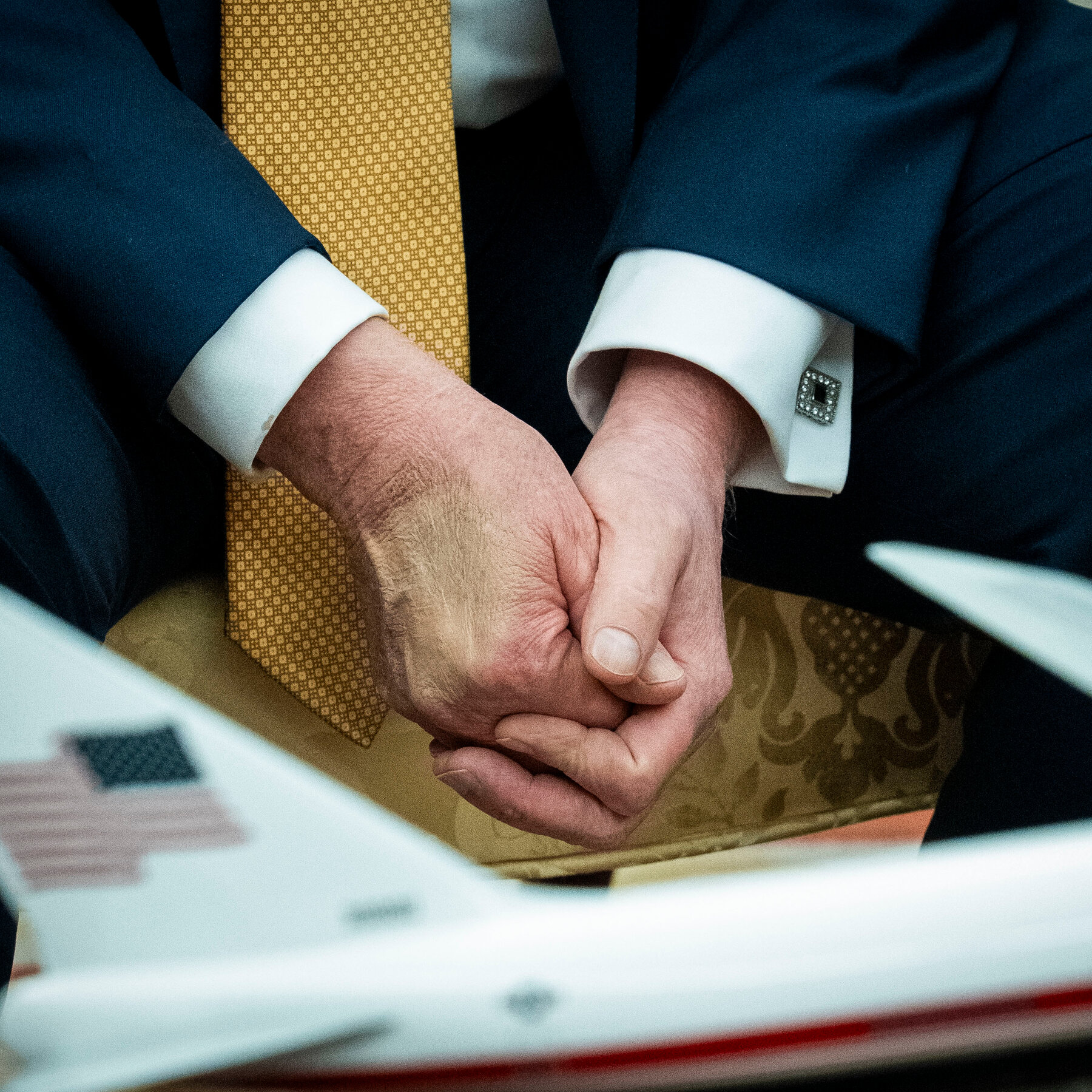 Trump Diagnosed With Chronic Venous Insufficiency After Leg Swelling. What Is It?