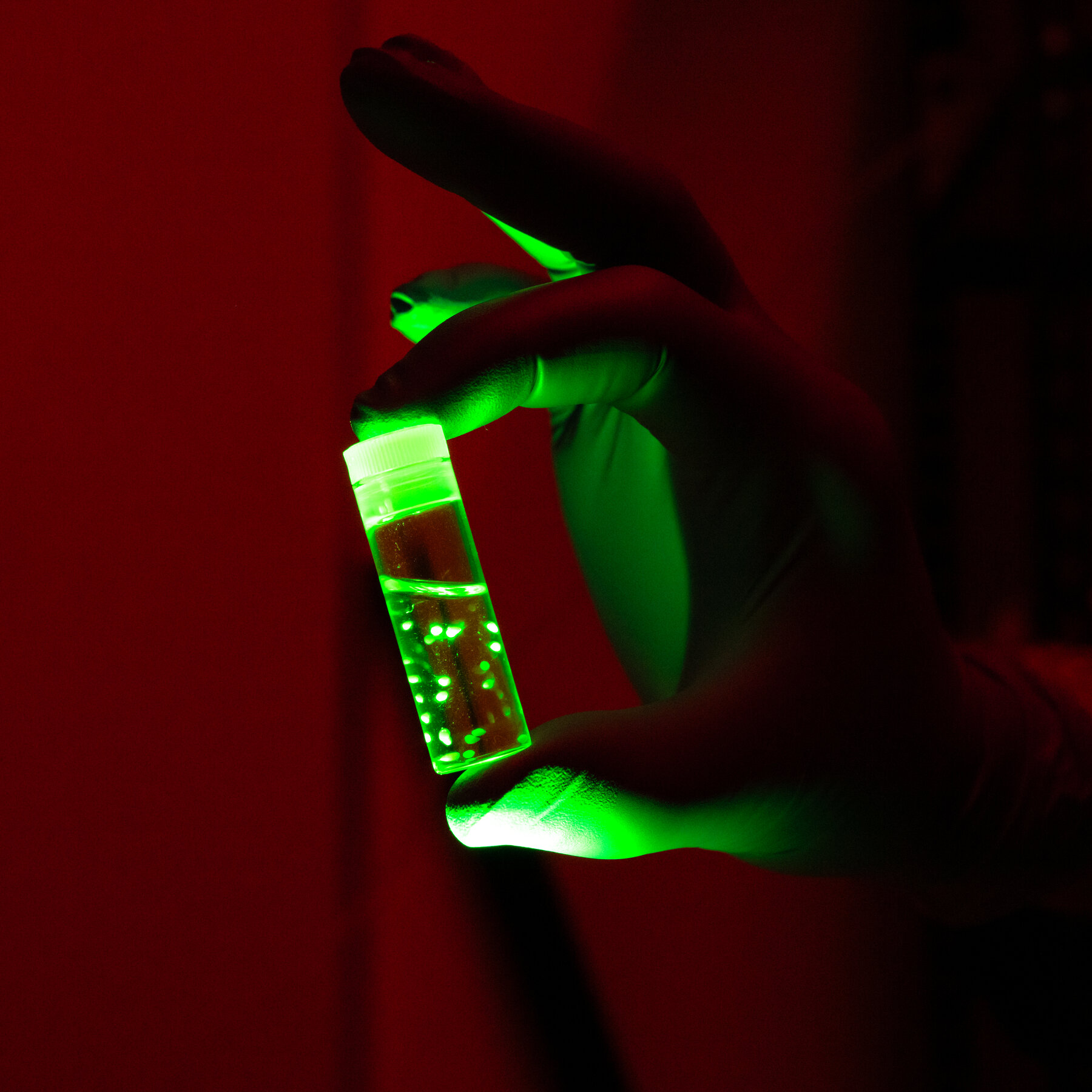 What Scientists Are Learning From Brain Organoids