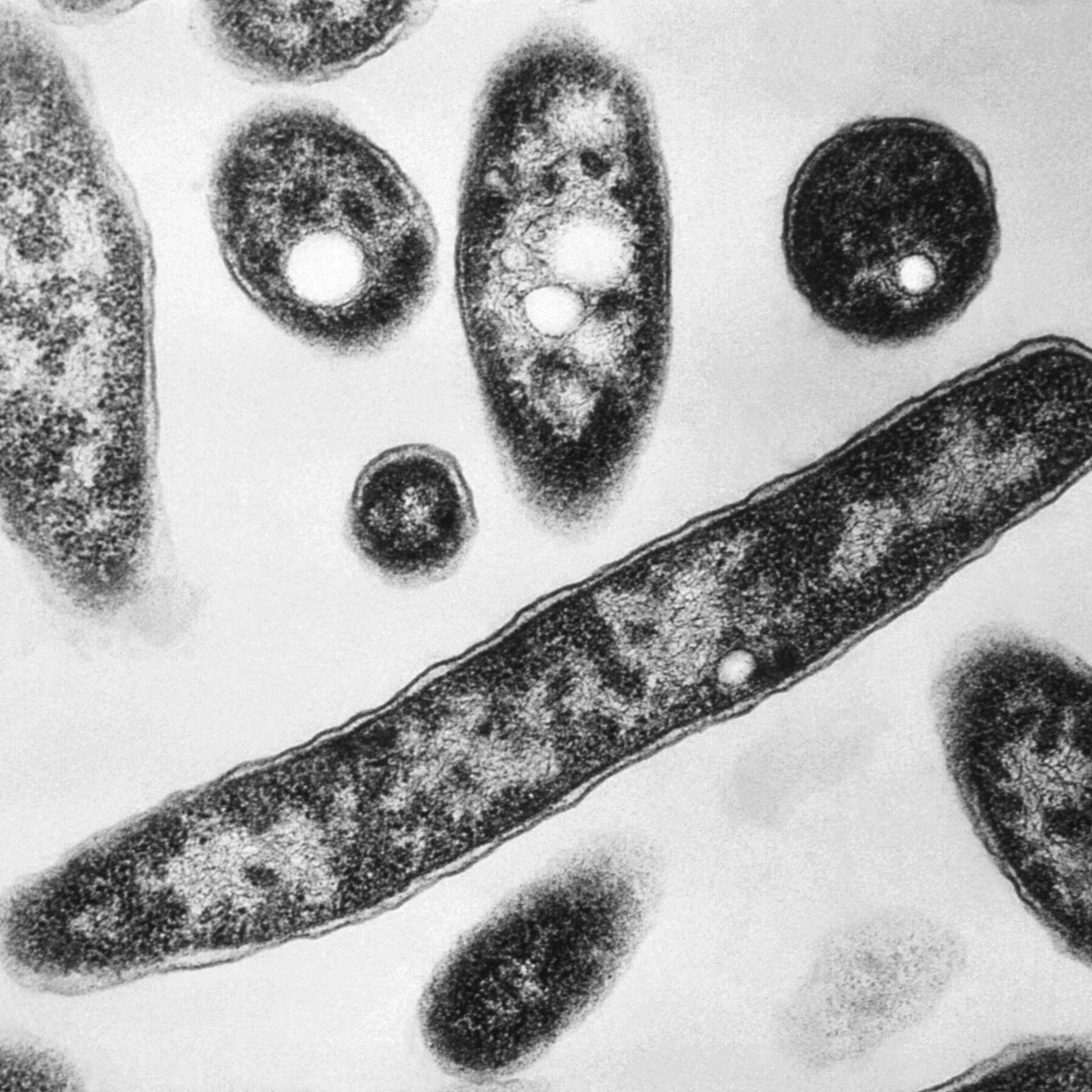 What to Know About Legionnaires’ Disease, Which Has Sickened 22 in N.Y.C.